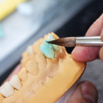 Зубной техник плюсы и минусы профессии